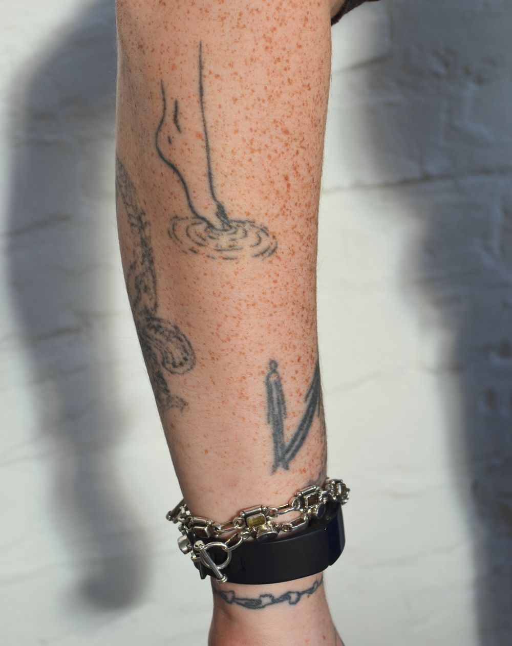 How effective is tattoo removal