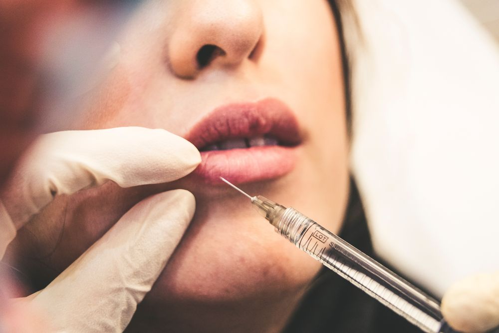 guide to lip fillers