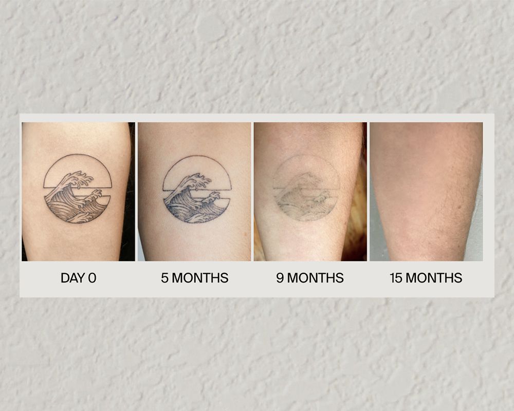 Ephemeral Tattoos: The Made-to-Fade Revolution — and Why Some Didn’t Disappear